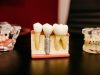 Dental