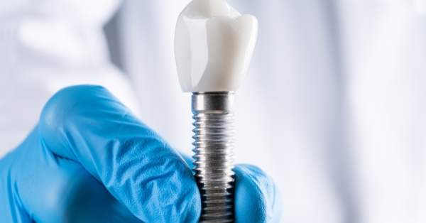 Why Should You Use Cylindrical Implants?