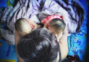 Sma type 1 jesy nelson