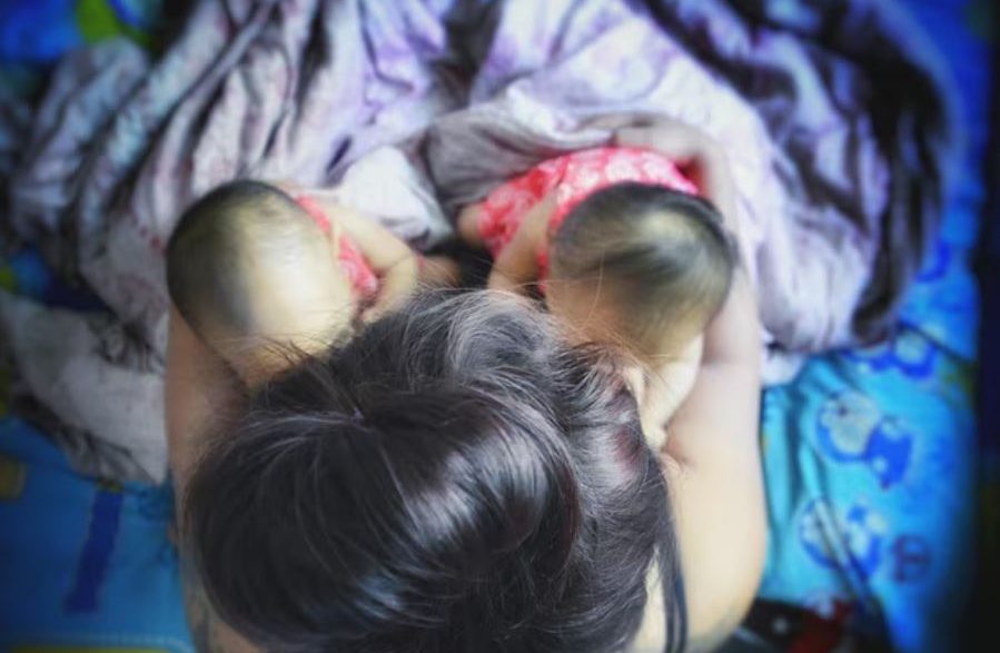 Sma type 1 jesy nelson